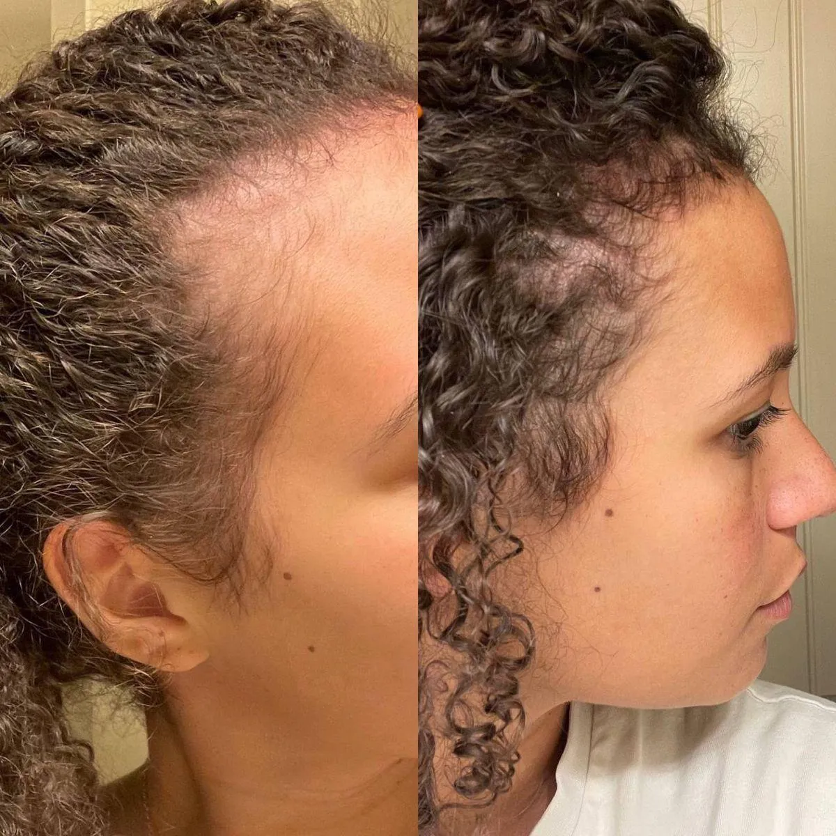 Antes e Depois - cabelo tratado